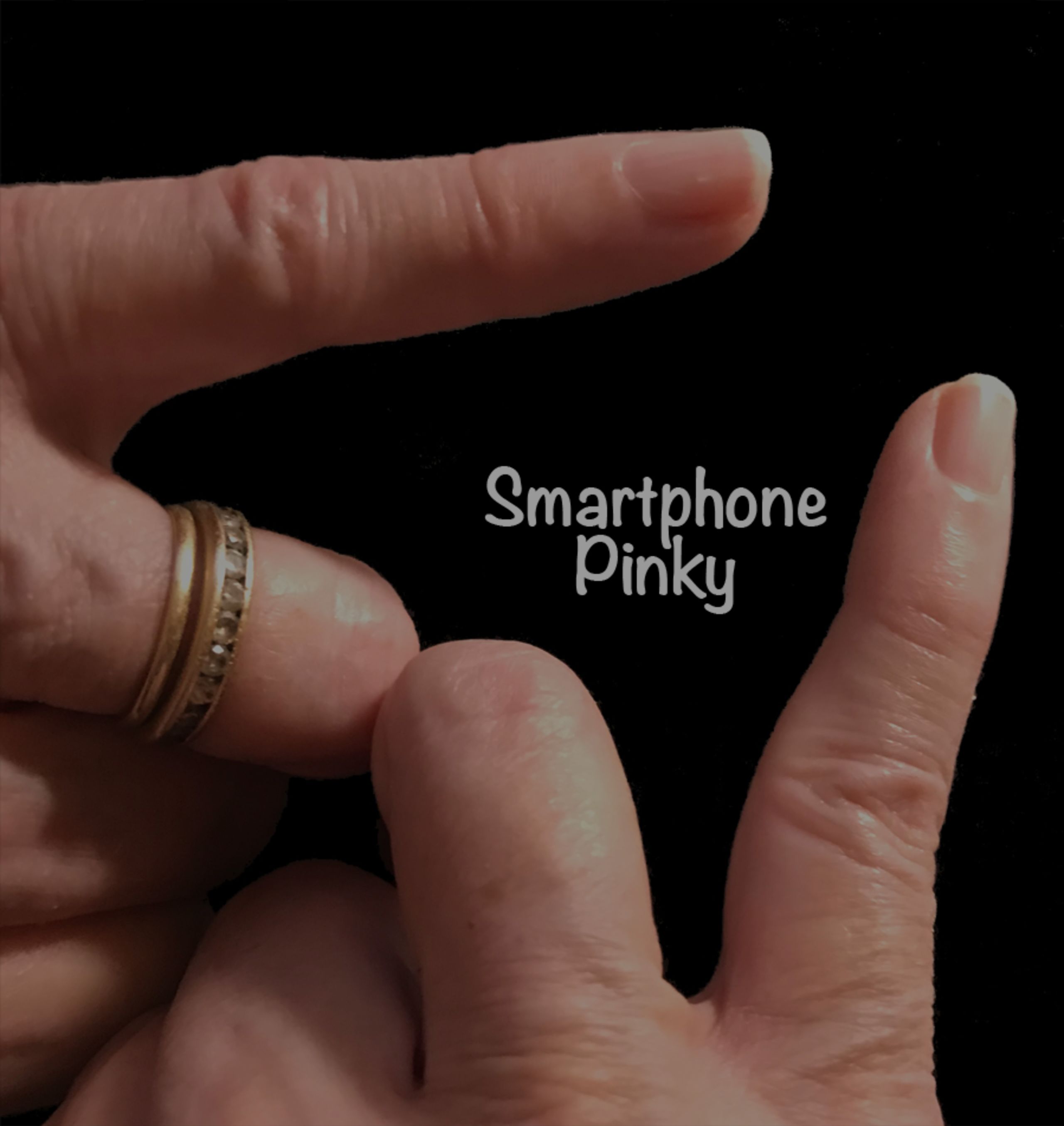 Smartphone pinky joins list of tech injuries
